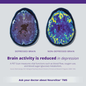 Brain Scan Poster 24x36